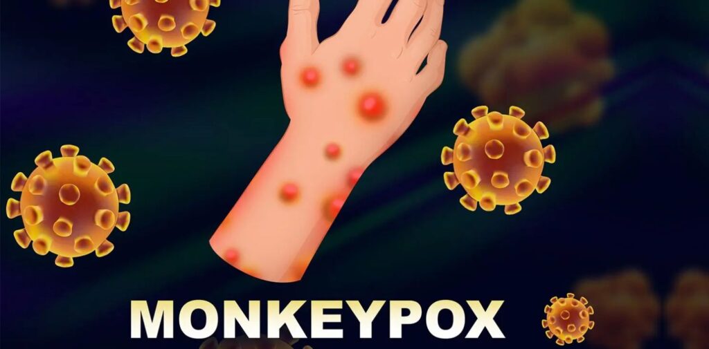 India-Reports-First-Suspected-Case-of-Monkeypox-A-Call-for-Vigilance-The-Emergence-of-Monkeypox-Nishant-Verma