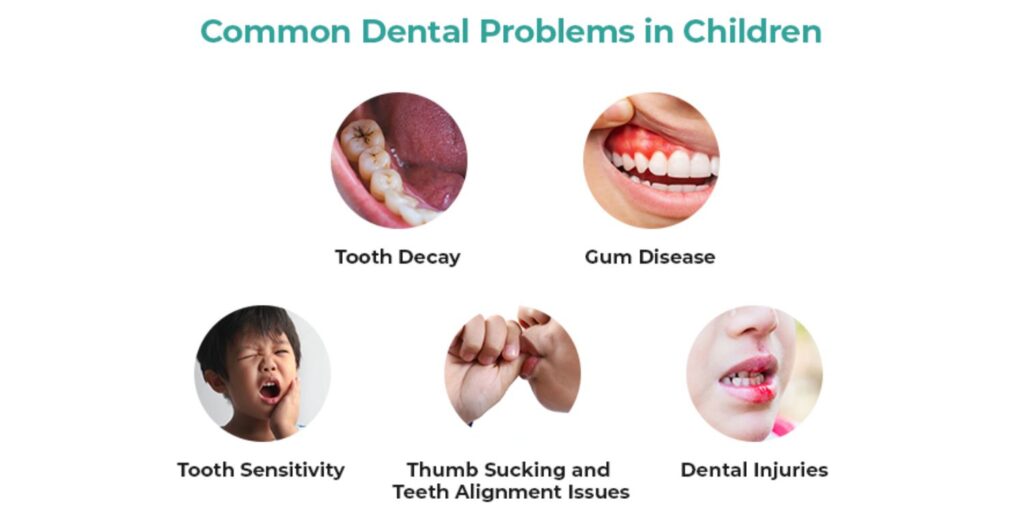 Common-Dental-Problems-in-Children